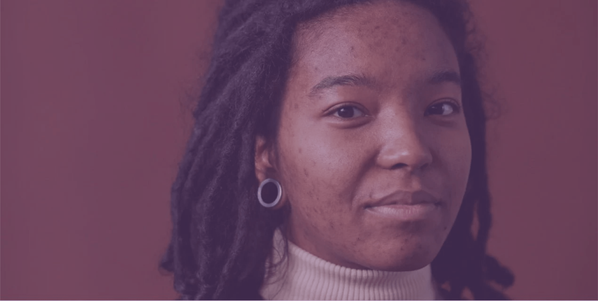 Acne and Common Part-Time Jobs For Students