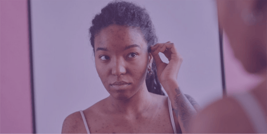 Acne and Scarring - SkinKitz