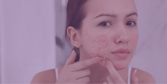 Common Acne-Fighting Ingredients And What They Do - SkinKitz