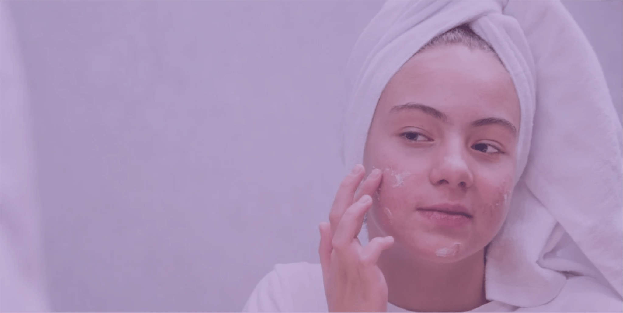 Complementary and Alternative Treatments for Acne
