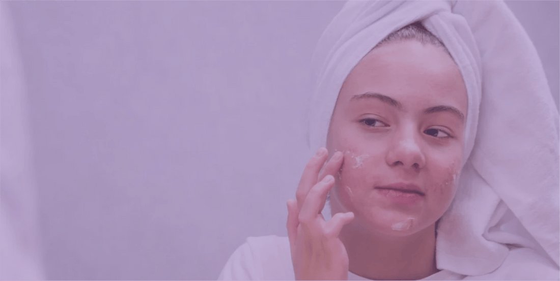 Complementary and Alternative Treatments for Acne - SkinKitz