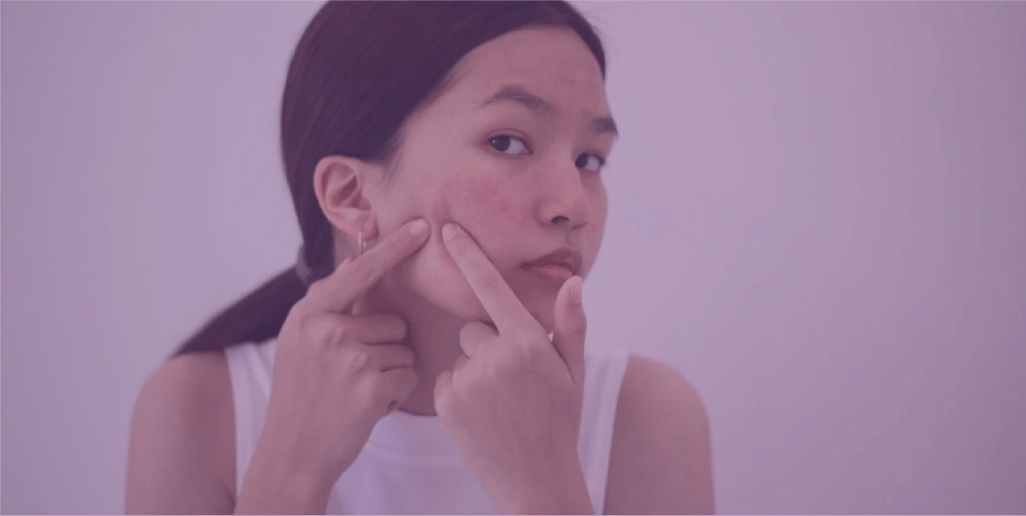 The Impact of Acne on Social Life