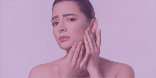 What If It’s Not Acne: Possible Differential Diagnosis for Acne Vulgaris - SkinKitz