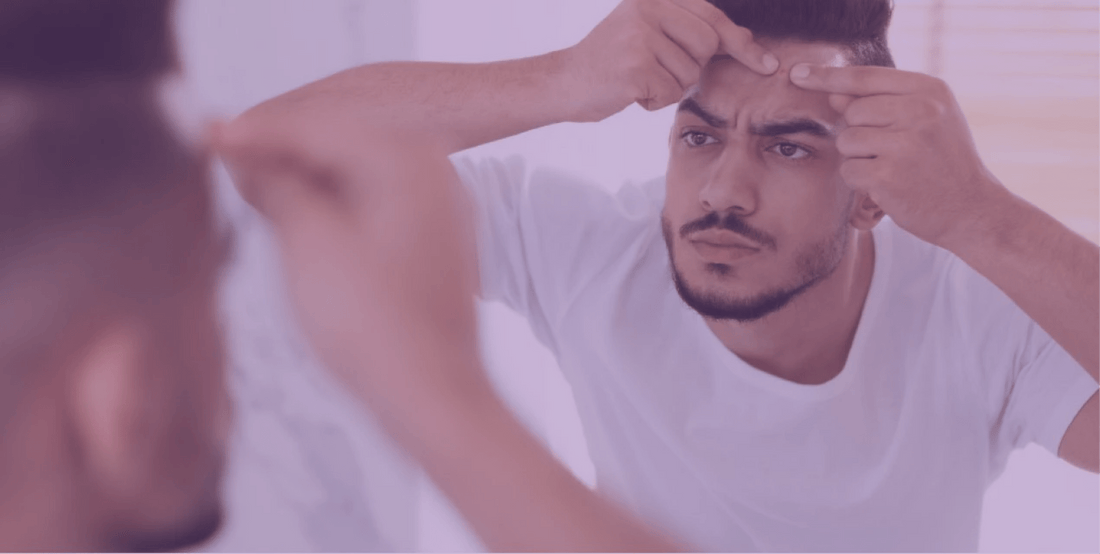 Why You Shouldn’t Pop Your Pimples - SkinKitz